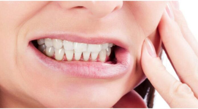 ¿Sabes que es el bruxismo y como solucionarlo?